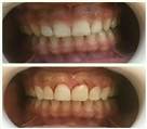 مرکز دندانپزشکی دکتر جنانی / دکتر برهانی - تصویر 4313