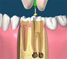 مرکز دندانپزشکی دکتر جنانی / دکتر برهانی - تصویر 5223