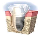 مرکز دندانپزشکی دکتر جنانی / دکتر برهانی - تصویر 5224