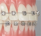مرکز دندانپزشکی دکتر جنانی / دکتر برهانی - تصویر 5225