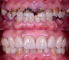 مرکز دندانپزشکی دکتر جنانی / دکتر برهانی - تصویر 7135