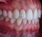 مرکز دندانپزشکی دکتر جنانی / دکتر برهانی - تصویر 7137