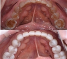 مرکز دندانپزشکی دکتر جنانی / دکتر برهانی - تصویر 7138