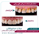 مرکز دندانپزشکی دکتر جنانی / دکتر برهانی - تصویر 7173
