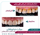 مرکز دندانپزشکی دکتر جنانی / دکتر برهانی - تصویر 7175