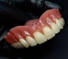 مرکز دندانپزشکی دکتر جنانی / دکتر برهانی - پروتز متحرک(دست دندان)