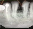 مرکز دندانپزشکی دکتر جنانی / دکتر برهانی - تصویر 7177
