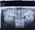 مرکز دندانپزشکی دکتر جنانی / دکتر برهانی - تصویر 7842