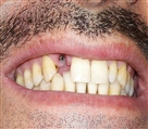6031