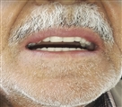 لابراتور دندانسازی احمدی - تصویر 8519