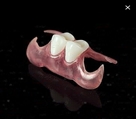 لابراتور دندانسازی احمدی - فیلیپر دندانی