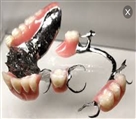 لابراتور دندانسازی احمدی - پروتز کروم و کوبالت