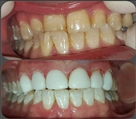 مرکز دندانپزشکی وصال - تصویر 8819