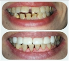 مرکز دندانپزشکی وصال - تصویر 8820