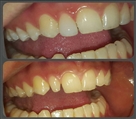 مرکز دندانپزشکی وصال - تصویر 8821