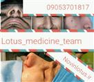جراحی بینی گروه پزشکان لوتوس - تصویر 51272