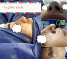 جراحی بینی گروه پزشکان لوتوس - تصویر 51346