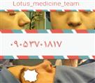 جراحی بینی گروه پزشکان لوتوس - تصویر 51414