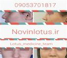 جراحی بینی گروه پزشکان لوتوس - تصویر 51416