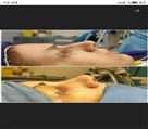 جراحی بینی گروه پزشکان لوتوس - تصویر 55223