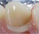 لابراتوار پروتزهای دندانی کیارش - تصویر 70574