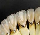 لابراتوار پروتزهای دندانی کیارش - تصویر 70579