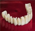 لابراتوار پروتزهای دندانی کیارش - تصویر 70580