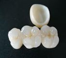 لابراتوار پروتزهای دندانی کیارش - تصویر 70581