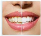 لابراتوار پروتزهای دندانی کیارش - تصویر 70590