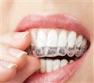 لابراتوار پروتزهای دندانی کیارش - تصویر 70591