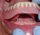 لابراتوار پروتزهای دندانی کیارش - تصویر 70596