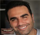 دندانپزشکی دکتر حسین توسلی زاده - طراحی لبخند با کامپوزیت های ips