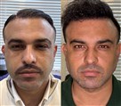 کلینیک پوست، مو و لیزر و لاغری تاج کلینیک - بهترین تزریق فیلر و زاویه سازی آقایان کرج 
