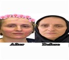 کلینیک پوست، مو و لیزر و لاغری تاج کلینیک - بهترین دکتر و کلینیک تزریق فیلر فول فیس و کانتورینگ حرفه ای کرج 