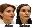 کلینیک پوست، مو و لیزر و لاغری تاج کلینیک - بهترین دکتر و کلینیک تزریق فیلر فول فیس و کانتورینگ حرفه ای کرج 