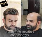 موسسه ترمیم مو نیوفیس - تصویر 77630