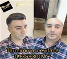 موسسه ترمیم مو نیوفیس - تصویر 77631