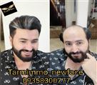 موسسه ترمیم مو نیوفیس - تصویر 77632