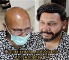 موسسه ترمیم مو نیوفیس - تصویر 77633