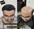 موسسه ترمیم مو نیوفیس - تصویر 77634