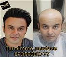 موسسه ترمیم مو نیوفیس - تصویر 77635