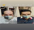 موسسه ترمیم مو نیوفیس - تصویر 77639