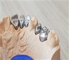 لابراتوار دندانسازی مفید - تصویر 81391
