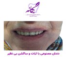 لابراتوار تخصصی دیجیتال پروتزهای دندانی یگانه - دندان مصنوعی