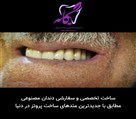 لابراتوار تخصصی دیجیتال پروتزهای دندانی یگانه - دندان مصنوعی