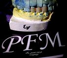 لابراتوار دیجیتال تخصصی پروتزهای دندانی یگانه - PFM