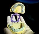 لابراتوار تخصصی پروتزهای دندانی یگانه - PFM