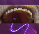 لابراتوار دیجیتال تخصصی پروتزهای دندانی یگانه - پارسیل