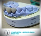 لابراتوار تخصصی پروتزهای دندانی یگانه - PFM