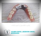 لابراتوار دیجیتال تخصصی پروتزهای دندانی یگانه - فلکسیبل